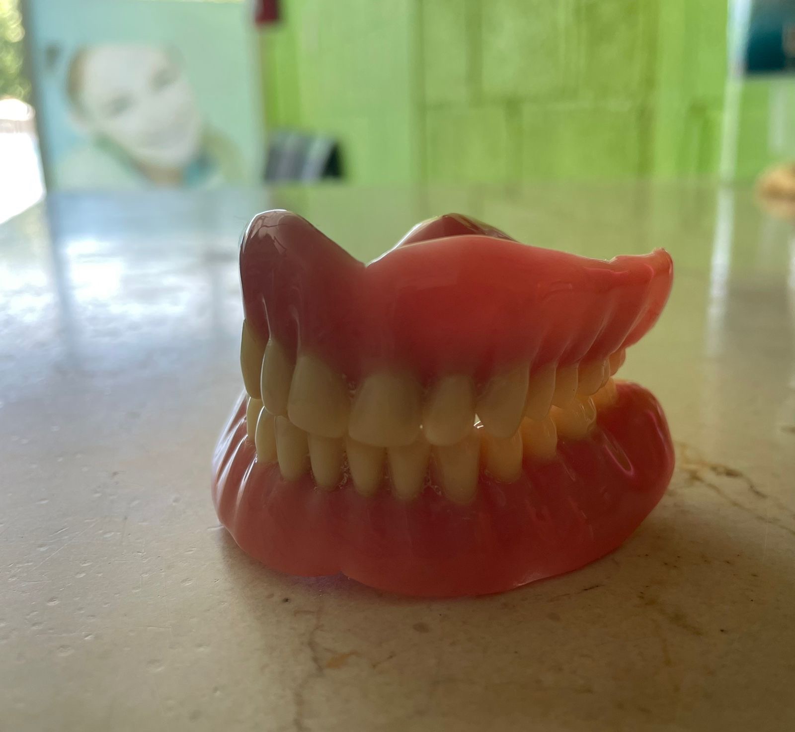 Servicio de diseño de sonrisa