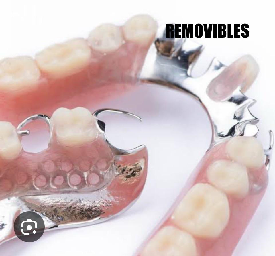 Servicio de removibles