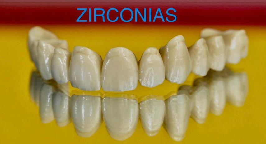 Servicio de zirconias